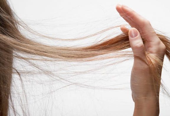Women hair loss treatment in Saudi Arabia