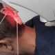 Robotic hair transplant in