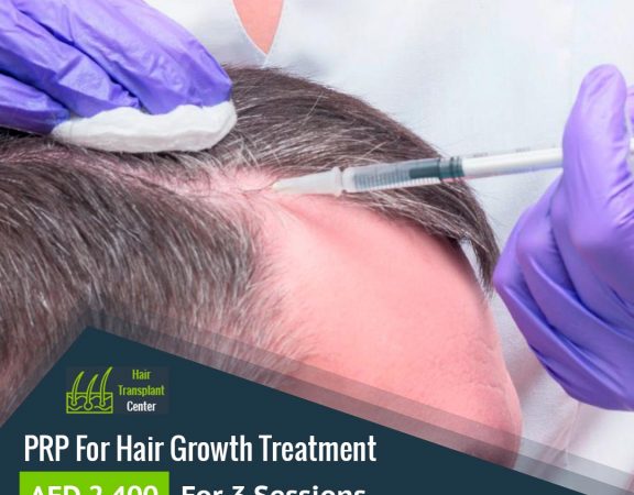 Hair transplant offers in Dubai